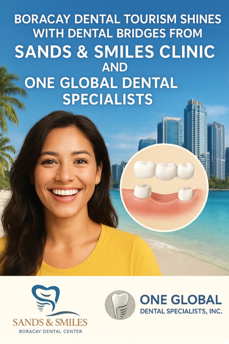 Boracay Dental Tourism Shines as Sands and Smiles Dental Clinic and One Global Dental Specialists Offer Premium Dental Bridges